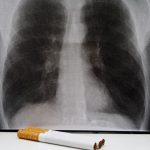 1605557929_10-faits-sur-la-maladie-pulmonaire-obstructive-chronique-MPOC.jpg