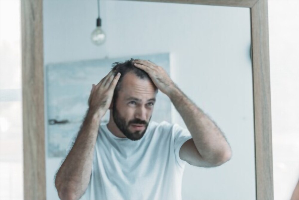Perte de cheveux chez l'homme